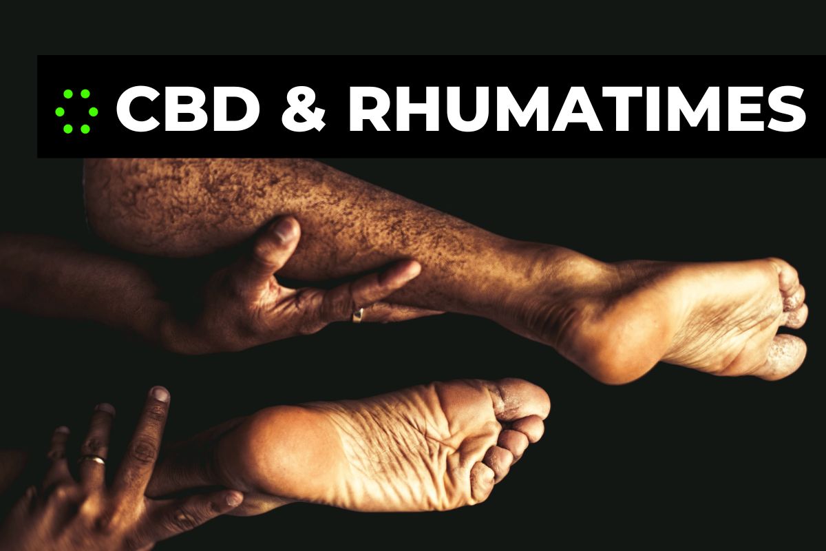 Lire la suite à propos de l’article Diminuer les souffrances causées par les rhumatismes grâce aux perles de CBD !